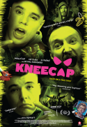 Kneecap